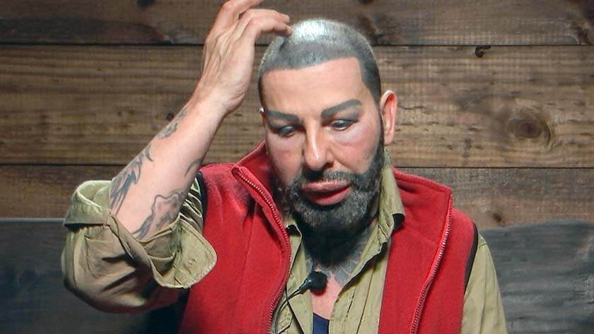 Große Überraschung: Harald ist ein Botox-Junkie